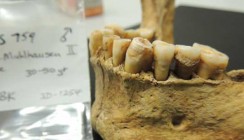 Zahnstein gewährt Einblick in die Evolutionsgeschichte