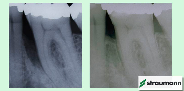 Es werden alle älter – auch die Patienten