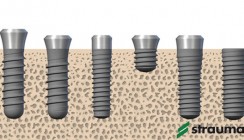 Roxolid – ein Implantatmaterial erobert den Markt
