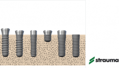 Straumann führt Lifetime Plus Garantie für Roxolid-Implantate ein