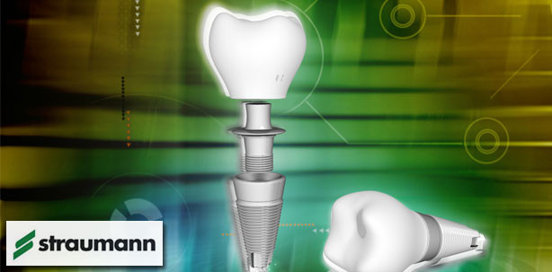 Untersuchung zeigt: Niedrigere Verluste bei Straumann-Implantaten