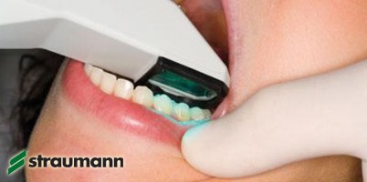iTero Intraoral-Scanner: Straumann gibt Exklusivvertrieb auf
