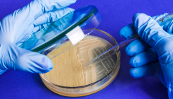 Streptococcus mutans als Ursache für systemische Erkrankung