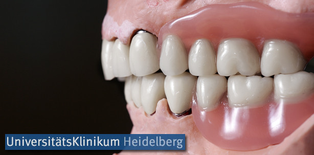 Unzufrieden mit der Zahnprothese? Studienteilnehmer gesucht!