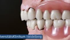 Unzufrieden mit der Zahnprothese? Studienteilnehmer gesucht!