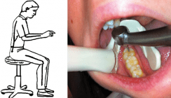 Endodontische Behandlungen ohne Assistenz?