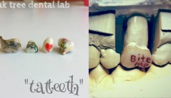 Tattooth – die Krone mit dem extra Blickfang