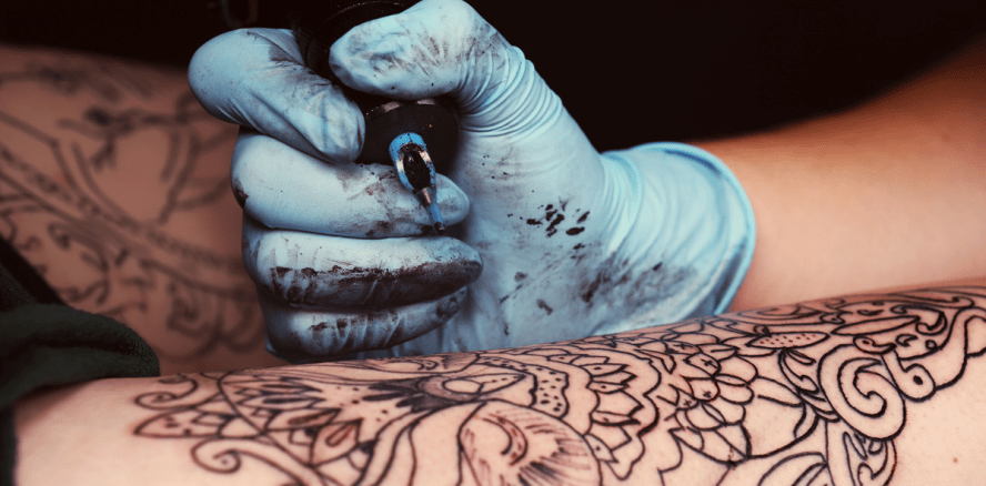 Für immer? Nein! Medizinische Tattoo-Entfernung nimmt stark zu