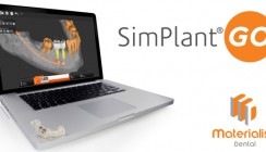 SimPlant® GO: Intuitive Bedienung, zuverlässiges Ergebnis