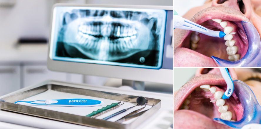 Vorsorge ist besser als Nachsorge