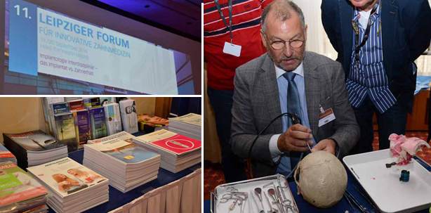 Kontroverse Positionen in Leipzig – Implantat vs. Zahnerhalt