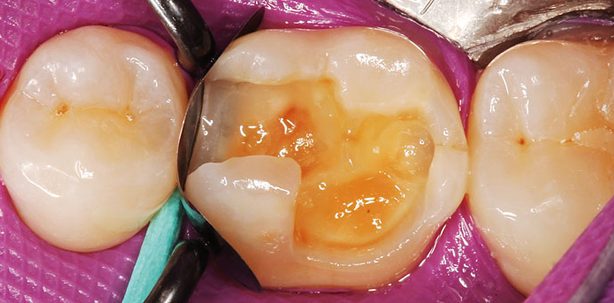 Form und Farbe – Determinanten auch bei Teilmatrizen?