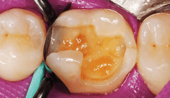 Form und Farbe – Determinanten auch bei Teilmatrizen?