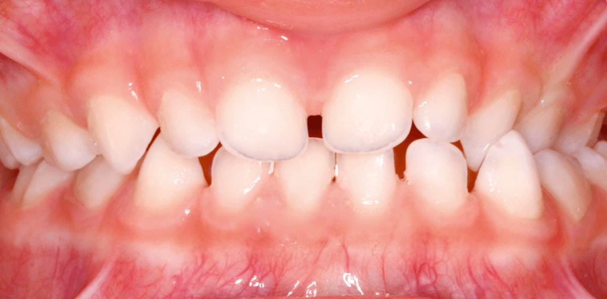 Der progene Formenkreis