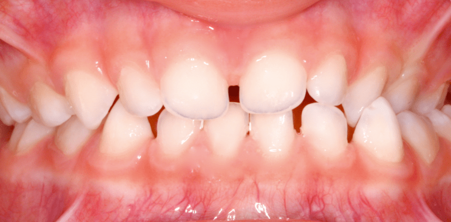 Der progene Formenkreis