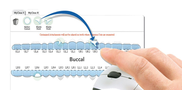 Das iPhone für die Zähne