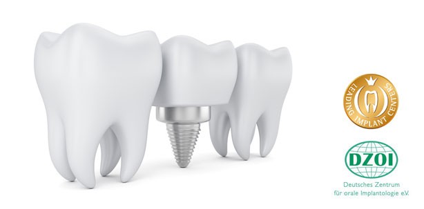 Leading Implant Centers und DZOI kooperieren