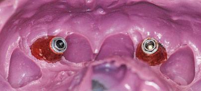 articleImage