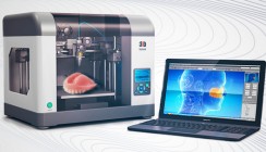 Krebspatient erhält Oberkiefer aus dem 3-D-Drucker