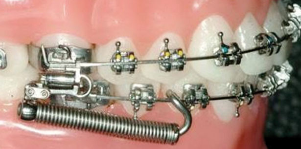 Effektive und vorhersagbare Korrektur