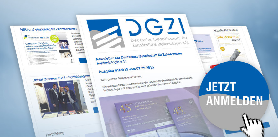 Neuer Newsletter der DGZI: Implantologie auf den Punkt gebracht
