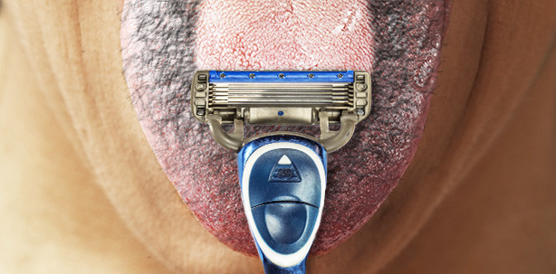 Haare statt Belag: Zungenrasur für 48-Jährigen