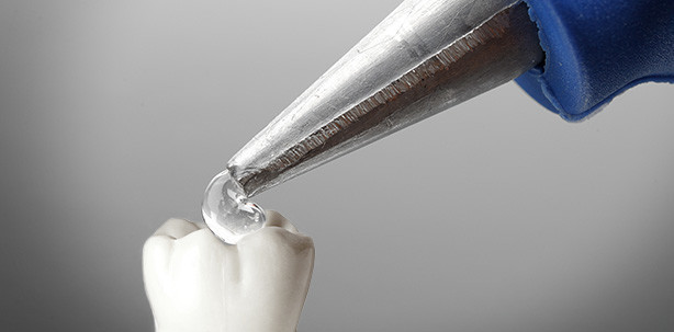 Extreme Zahnarztangst: Frau befestigt Zähne mit Superkleber