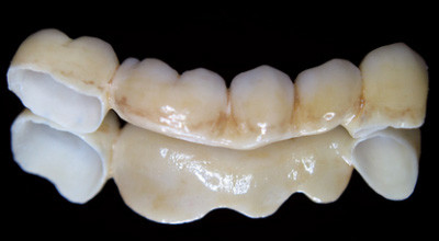 Gerüstherstellung abseits des Mainstream