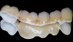 Gerüstherstellung abseits des Mainstream