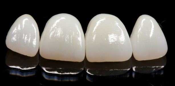 Es muss nicht immer geschichtet sein