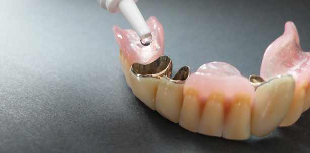 Mundgesundheit bei ­Modellguss-Teleskopprothesen