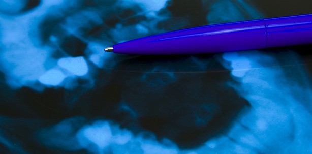 Bildgebungsverfahren schließt Terahertz-Lücke