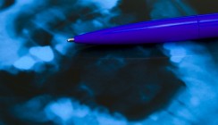 Bildgebungsverfahren schließt Terahertz-Lücke