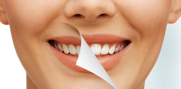 Zähne zeigen: Bleaching-Produkte im Test