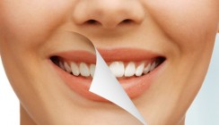 Zähne zeigen: Bleaching-Produkte im Test