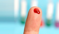 Neuer Bluttest revolutioniert Krankheitsdiagnose