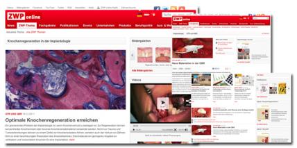 Neues ZWP-Thema „Knochen- und Geweberegeneration“