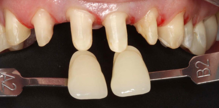 Durch strukturierte Therapieplanung zu einem strahlenden Lächeln