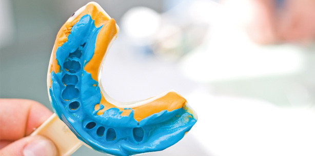 Hygieneschwäche – Abdruckdesinfektion