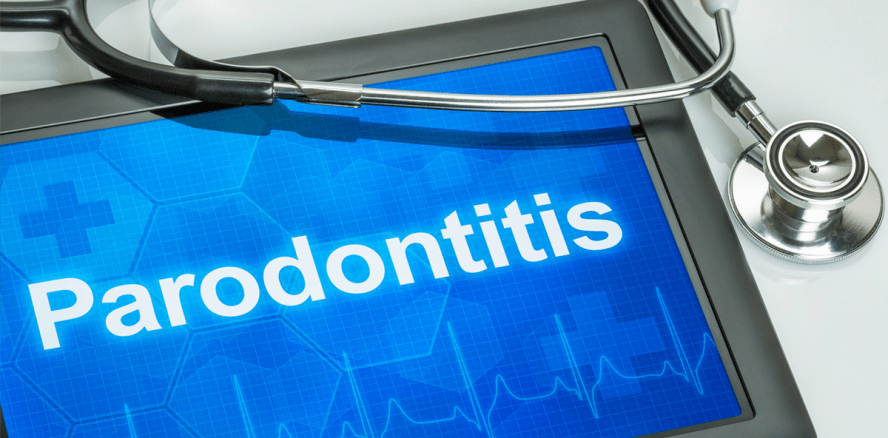 Patientin stirbt während der Parodontitisbehandlung