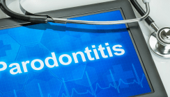 Patientin stirbt während der Parodontitisbehandlung