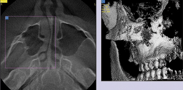 Einsatzmöglichkeiten der digitalen Volumentomografie