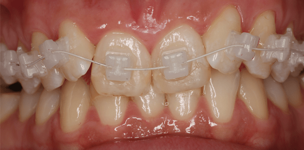 Highlight in Optik und Funktion