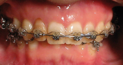 Versuche, Oberflächlichkeiten und Irrungen in der Diagnostik - Teil 1