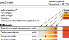 Parodontitisdiagnostik: Keime in der Mundhöhle