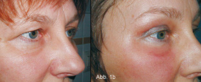 Individualästhetik in der Gesichtschirurgie