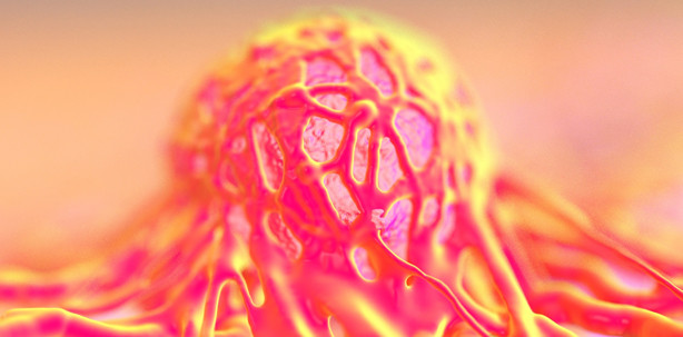 Mit hochpräziser Messmethode den Krebs einkreisen