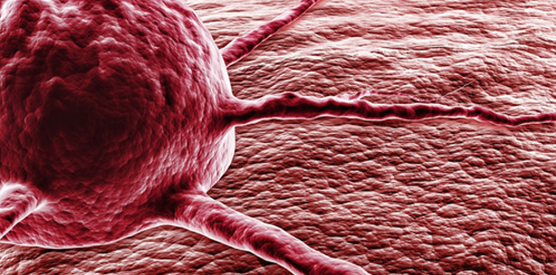 Selbstkontrolle des Immunsystems dämpft Krebsabwehr