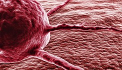 Selbstkontrolle des Immunsystems dämpft Krebsabwehr