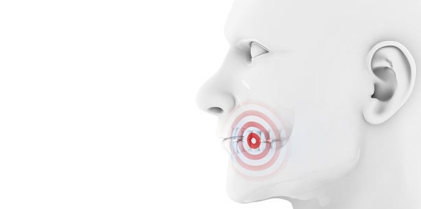 Gesichtsrekonstruktion dank neuartiger 3D-Prothese